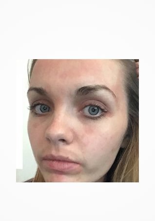 /-/media/project/loreal/brand-sites/lrp/apac/vn/simple-page/landing-page/brand-campaign/instagram_5.jpg?sc_lang=vi-vn