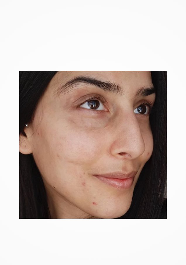 /-/media/project/loreal/brand-sites/lrp/apac/vn/simple-page/landing-page/brand-campaign/instagram_6.jpg?sc_lang=vi-vn
